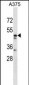 ZNF259 Antibody (C-term)